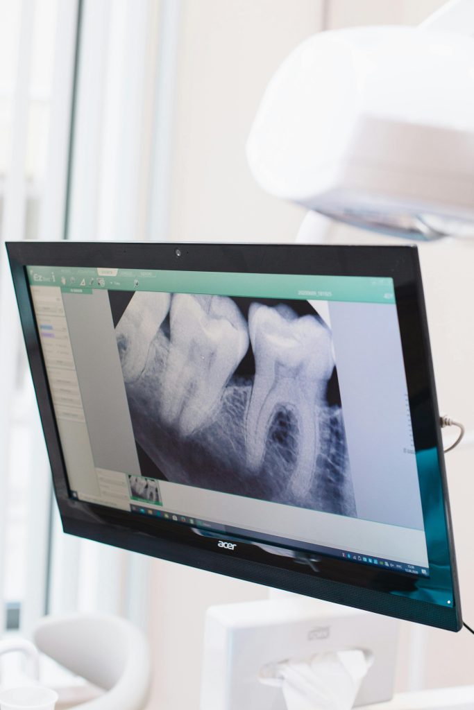 Dental X-ray - Brunswick Life Dental Clinic